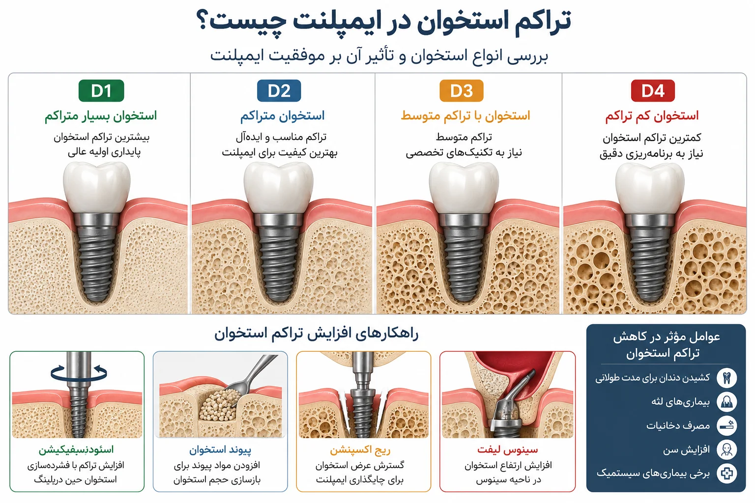 تراکم استخوان در ایمپلنت چیست؟ چرا کیفیت استخوان مهم‌تر از چیزی است که فکر می‌کنید؟
